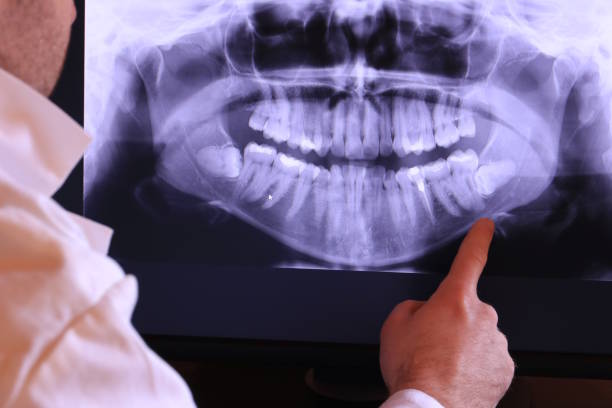 Best Emergency Dental Care for Broken or Chipped Teeth in Oakes, ND