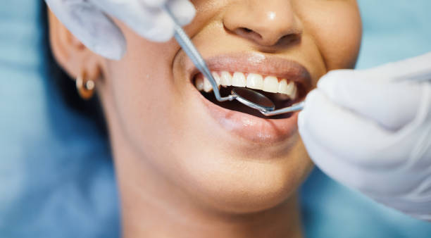 Best Emergency Wisdom Teeth Removal in Oakes, ND